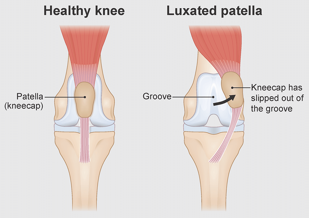 Illustration Luxating Patella in Dogs